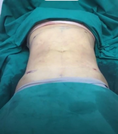 Review Nalin jamikorn