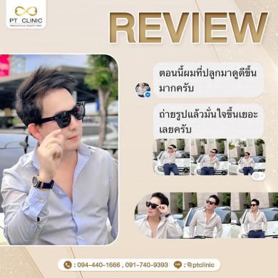 รีวิว ปลูกผม