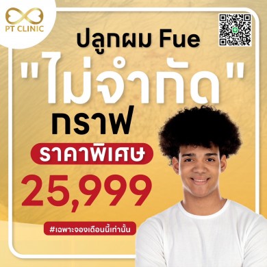 ปลูกผล Fue “ไม่จำกัด” กราฟ