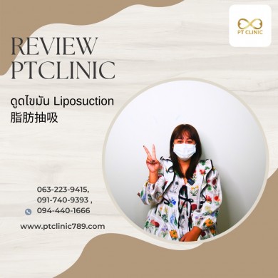 รีวิวดูดไขมัน